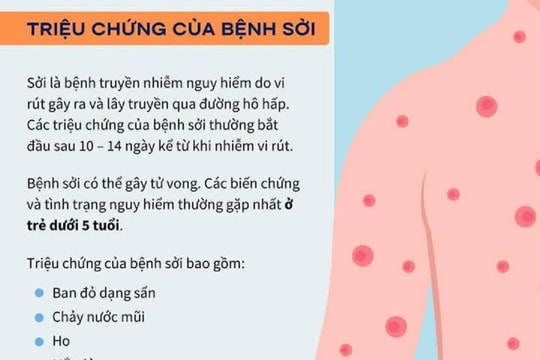 Nghệ An ghi nhận gần 1.100 ca sốt phát ban nghi sởi