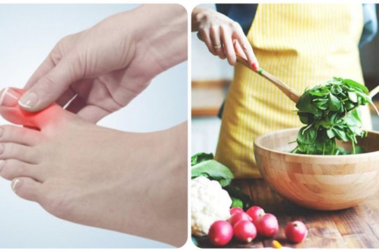 Axit uric cao nên ăn gì?