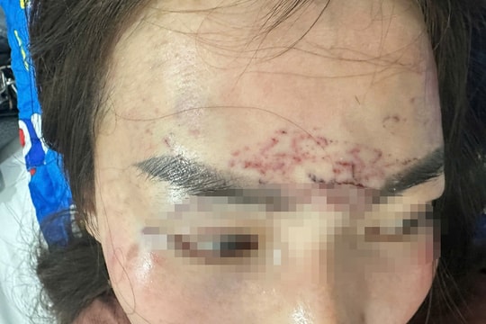 Khởi tố hai người phụ nữ vụ 'tra tấn' bằng axit và máy xăm