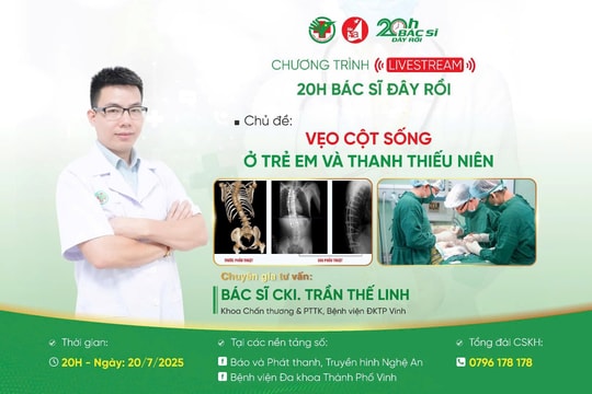 Đón xem livestream '20h Bác sĩ đây rồi' ngày 20/7: ‘Vẹo cột sống ở trẻ em và thanh thiếu niên- Những điều cần biết’