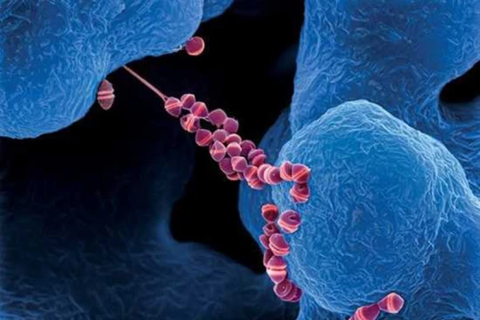 Infographic: Khuyến cáo các biện pháp phòng bệnh liên cầu lợn từ Bộ Y tế