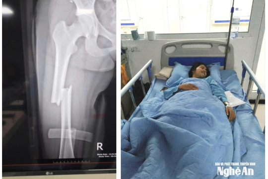 Khát vọng giảng đường đại học dang dở của nữ sinh mồ côi gặp tai nạn giao thông nghiêm trọng