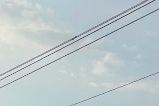 Hi hữu: Quăng dây câu cá, người đàn ông bị điện giật bỏng nặng toàn thân