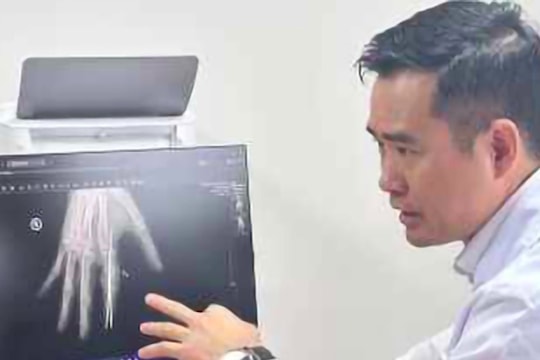 Cứu sống ngón tay đứt rời của thủy thủ sau 25 tiếng thiếu máu do tai nạn bão biển