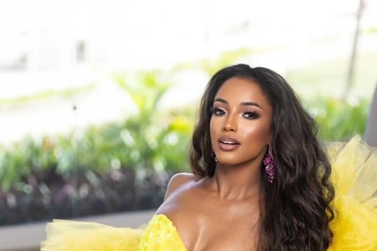 Miss Universe Jamaica: Chi phí điều trị 1,6 tỷ đồng sau sự cố té ngã