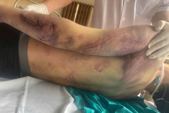 Đừng bắt trẻ em trưởng thành từ đau đớn