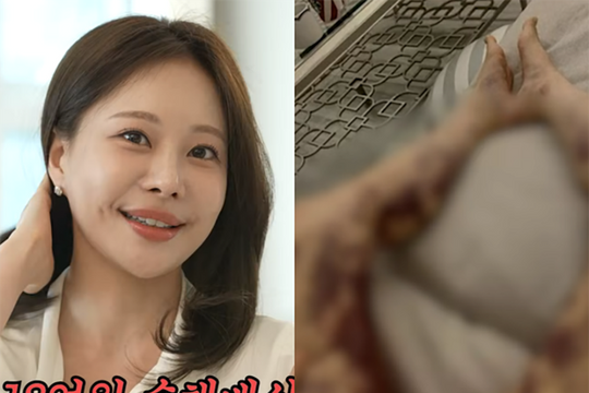 Người mẫu Aori công bố chi tiết vụ tai nạn y khoa và hành trình kiện tụng 4 năm