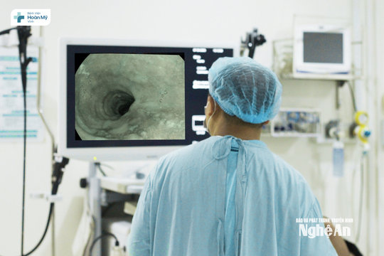 Không có triệu chứng, người đàn ông 53 tuổi phát hiện ung thư thực quản giai đoạn sớm qua nội soi tiêu hóa tại Hoàn Mỹ Vinh