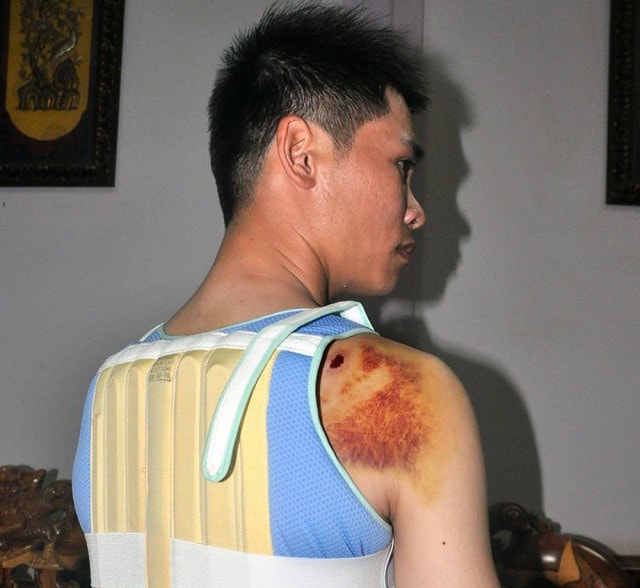 Bắt con trai bí thư xã đánh trọng thương người cãi nhau với bố