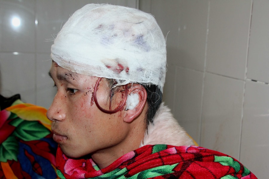 Vào rừng lấy lá dong Tết bị gấu hoang tấn công trọng thương