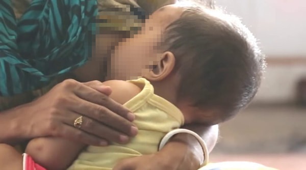 Bé 3 tuổi tử vong sau khi bú sữa mẹ nhiễm độc do rắn cắn