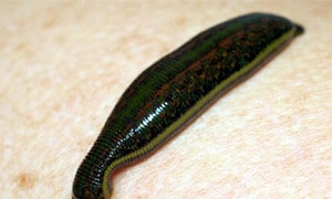 Người phụ nữ đi tắm sông bị đỉa chui vào mũi 