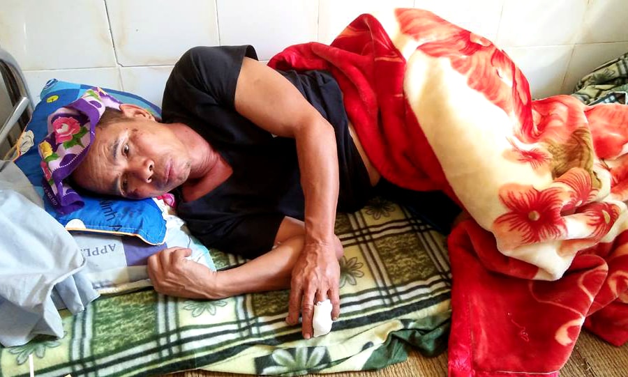 Dân làng vây bắt lợn rừng gần 1 tạ húc thủng bụng, cắn đứt ngón tay người