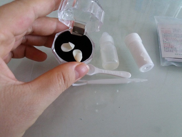 Mua răng... trên mạng, trào lưu làm đẹp nguy hiểm 