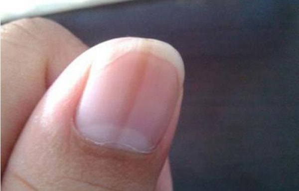 3 bộ phận trên cơ thể báo hiệu gan đang suy yếu