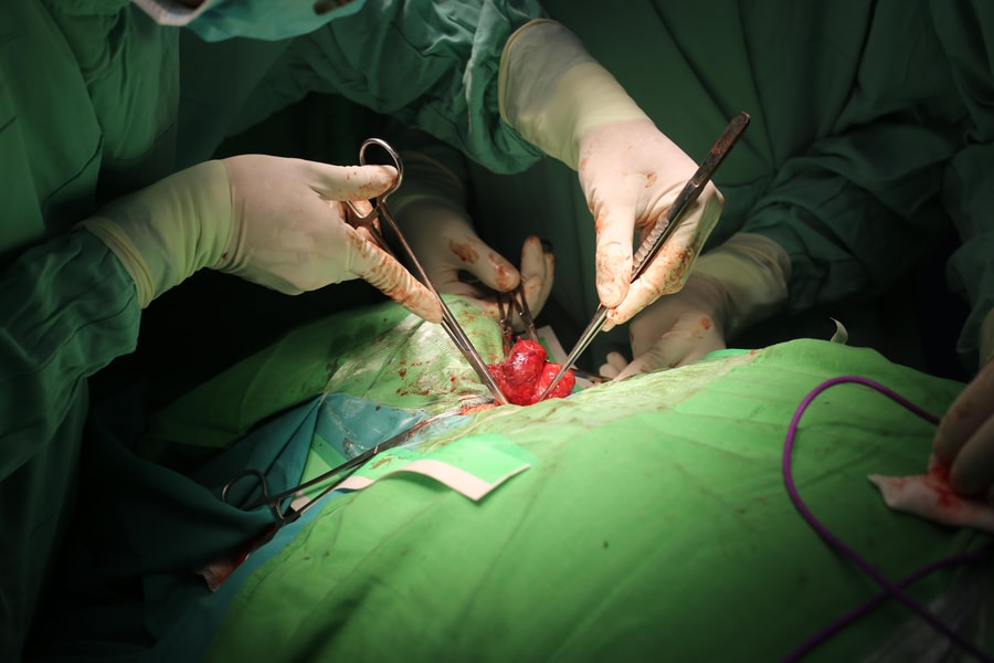 Cắt bỏ khối bướu cổ lớn đeo bám người phụ nữ hơn 5 năm