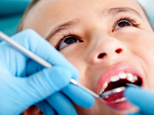 Xử trí khi răng sữa của trẻ bị đen