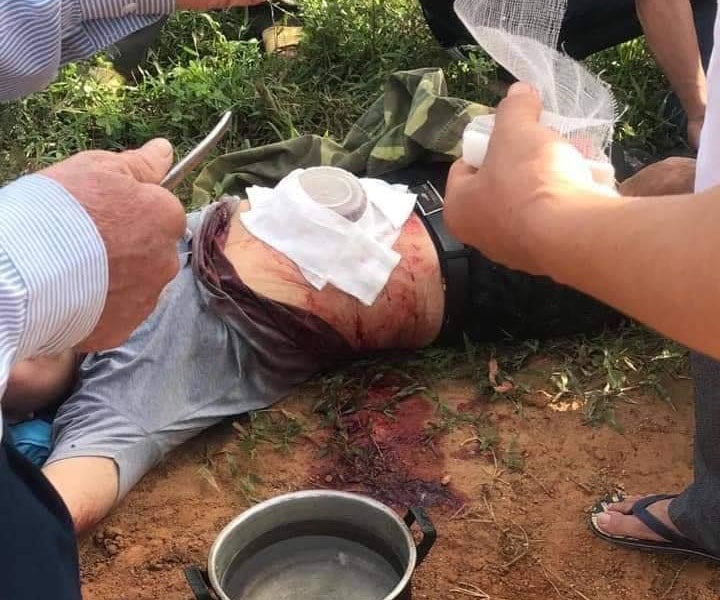 Sang hàng xóm lấy dao tự rạch bụng mình vì tưởng trong đó có bom 