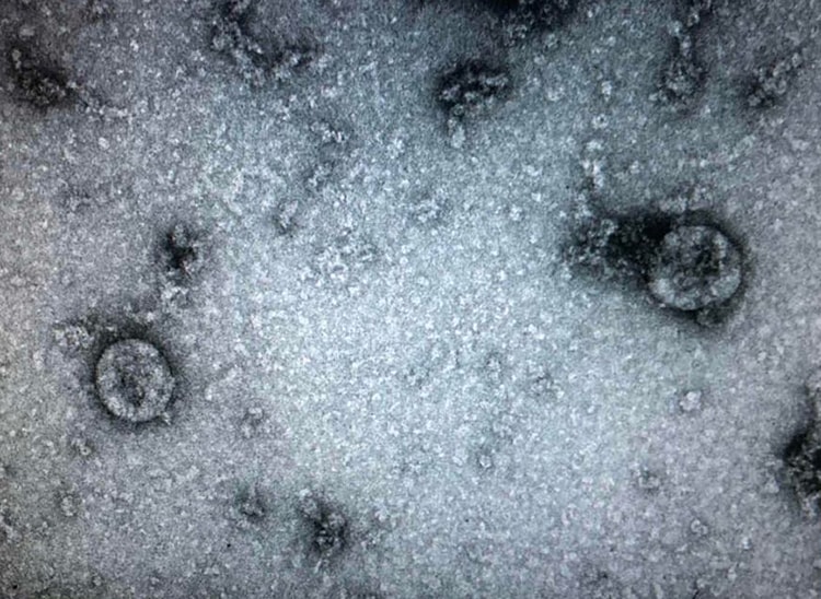 Nhà khoa học Việt tạo kit thử nCoV cho kết quả sau 70 phút