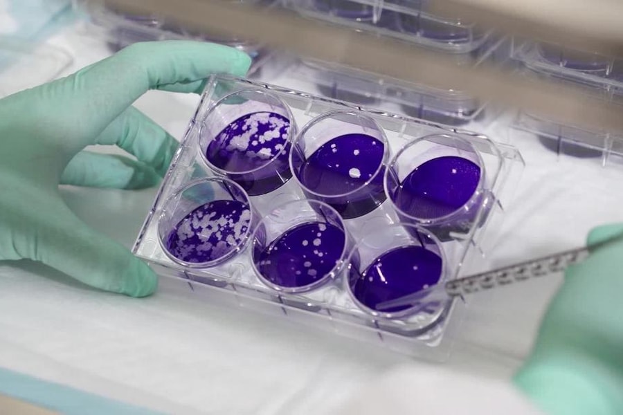 Thứ trưởng Y tế Anh dương tính với Covid-19