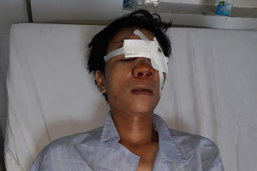 Cán bộ địa chính xã ở Nghệ An bị tố dùng xẻng đánh gục người sau va chạm giao thông