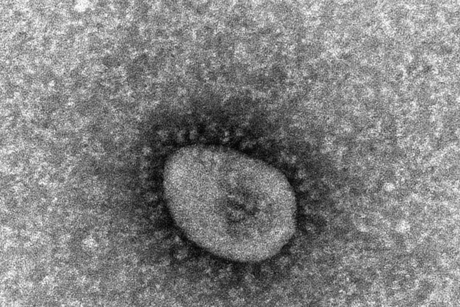 Biến chủng Omicron 'tàng hình' chiếm ưu thế tại TP. Hồ Chí Minh