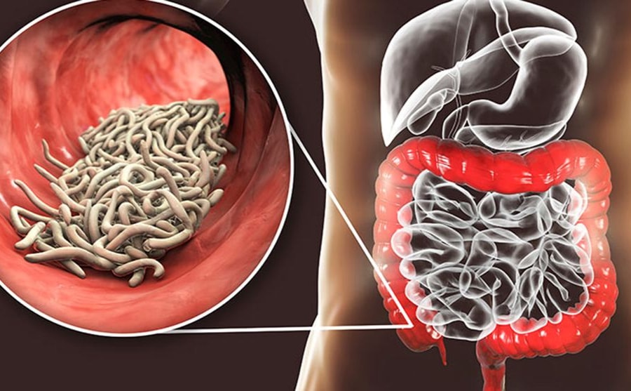 Nghệ An đẩy mạnh công tác phòng, chống bệnh ký sinh trùng