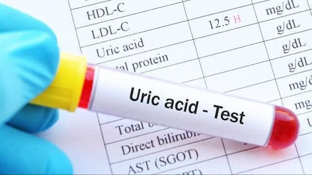 Từ bỏ thói quen ăn uống để hạn chế tăng acid uric