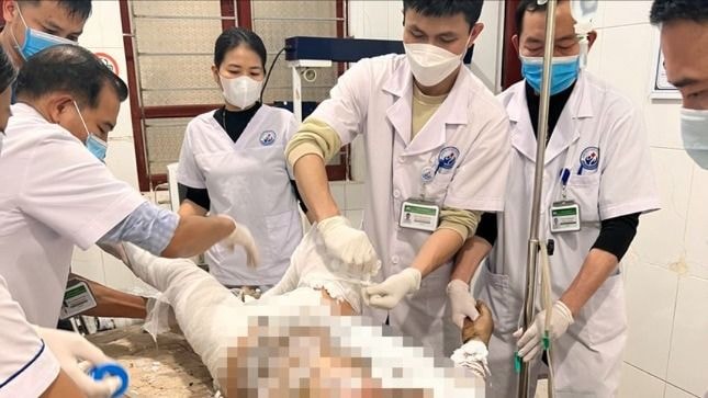 Chồng đổ xăng lên người rồi tự thiêu trước mặt vợ