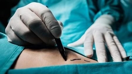 Hành vi mua bán bộ phận cơ thể người sẽ bị xử lý như thế nào?