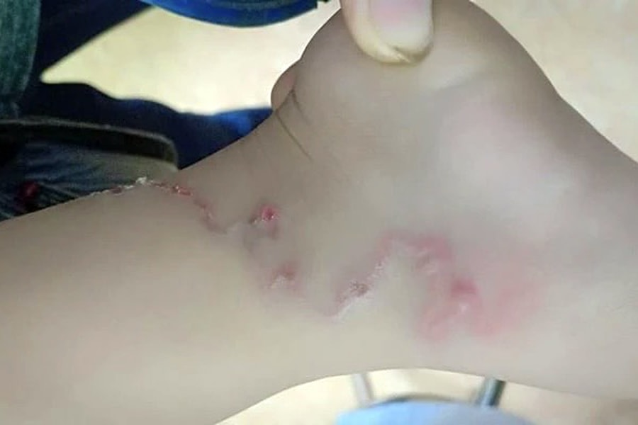 Cảnh giác với nguy cơ mắc bệnh lây truyền từ thú cưng