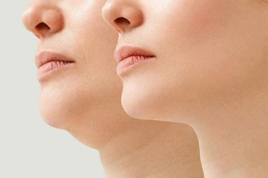 Bài tập giúp bạn thoát tình trạng cằm đôi khó chịu