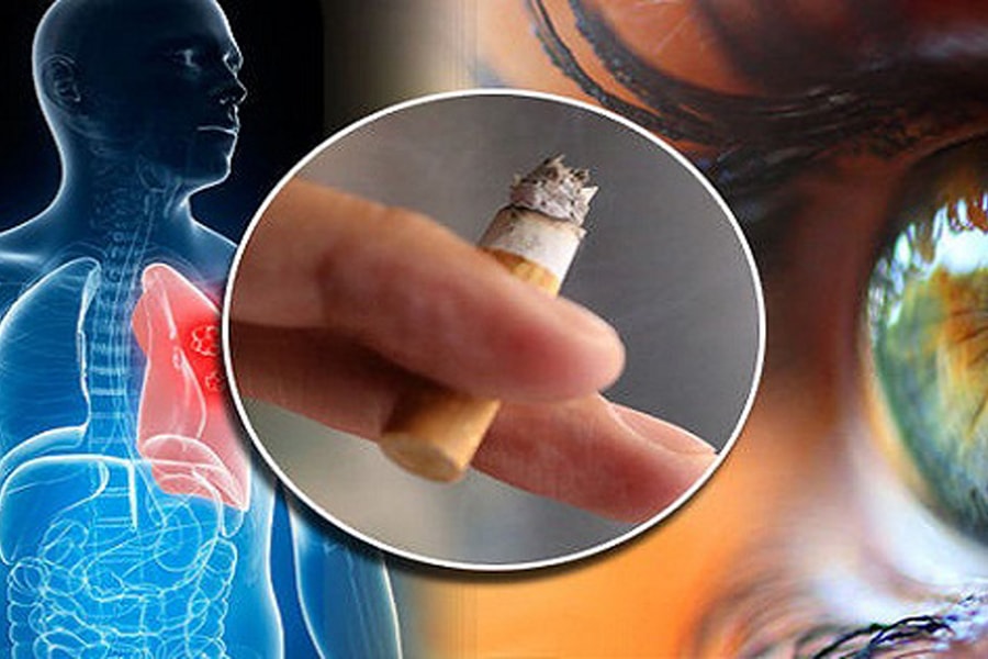 Hút thuốc lá gây ra hàng loạt bệnh về mắt