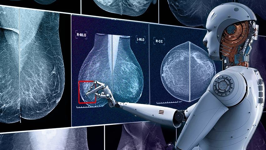 Trí tuệ nhân tạo đóng vai trò như thế nào trong cuộc chiến chống ung thư vú?