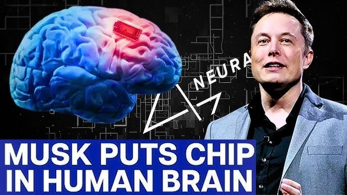 Neuralink của Elon Musk: Bước đột phá với thử nghiệm sử dụng cấy ghép não điều khiển cánh tay robot