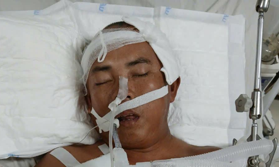 Nỗi khốn khổ của người đàn ông đi bốc gỗ keo thuê