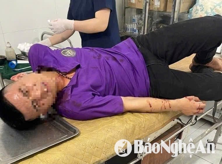 Xô xát sau khi suýt va chạm giao thông, tài xế và phụ xe nhập viện