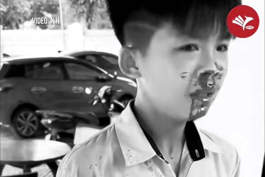 Nghi vấn phụ huynh đánh học sinh lớp 7 nhập viện