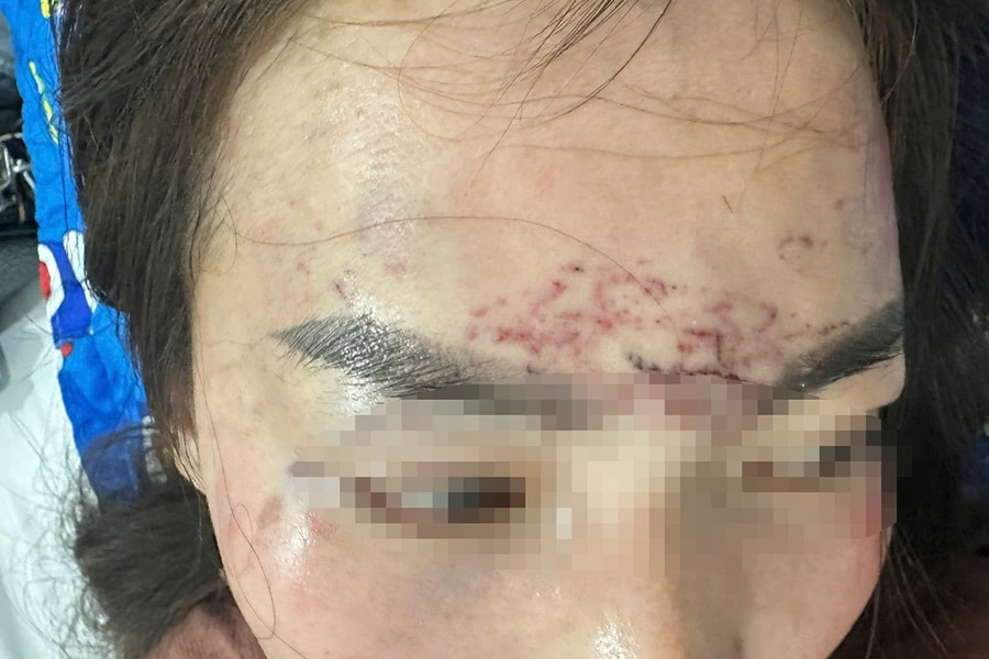 Khởi tố hai người phụ nữ vụ 'tra tấn' bằng axit và máy xăm