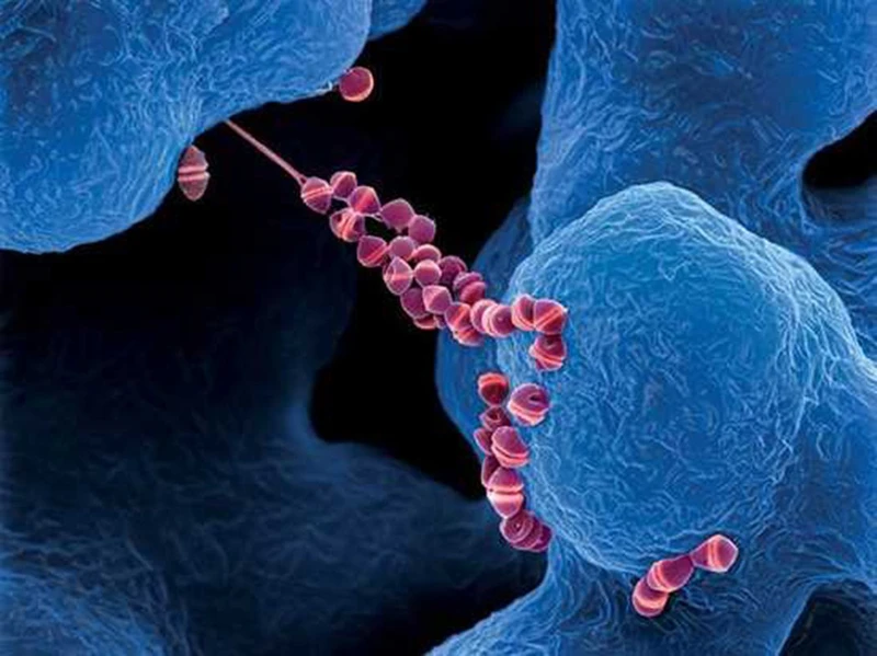 Infographic: Khuyến cáo các biện pháp phòng bệnh liên cầu lợn từ Bộ Y tế