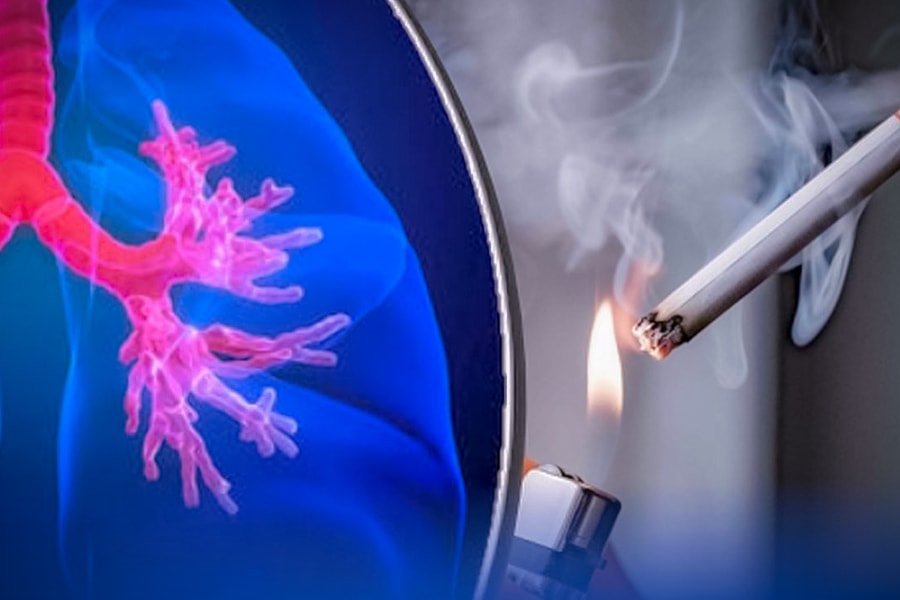 Hút thuốc lá làm gia tăng nguy cơ mắc các bệnh hô hấp