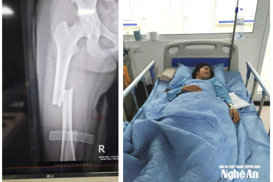 Khát vọng giảng đường đại học dang dở của nữ sinh mồ côi gặp tai nạn giao thông nghiêm trọng