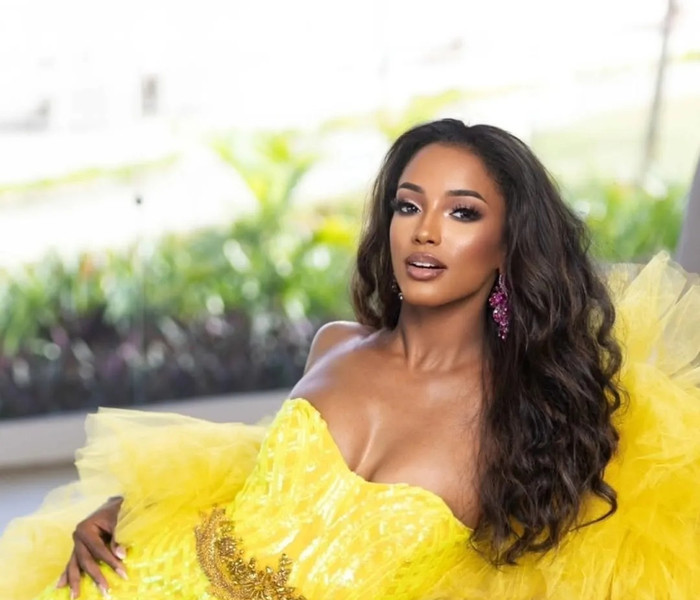 Miss Universe Jamaica: Chi phí điều trị 1,6 tỷ đồng sau sự cố té ngã