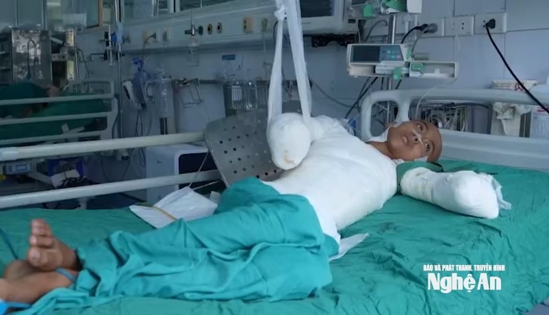 Ước mơ dang dở của cậu thiếu niên 15 tuổi bị tai nạn thương tâm