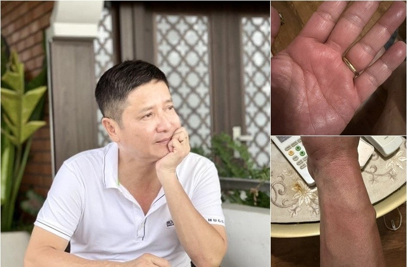NSƯT Chí Trung hồi phục sau 6 tháng mất ngủ vì nhiễm giun đũa chó