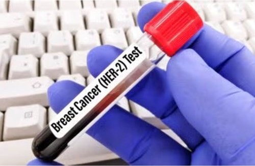 FDA ưu tiên xem xét thuốc giredestrant của Roche giúp giảm 30% nguy cơ tái phát ung thư vú